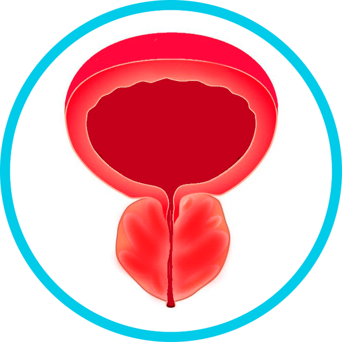 Síntomas de prostatite